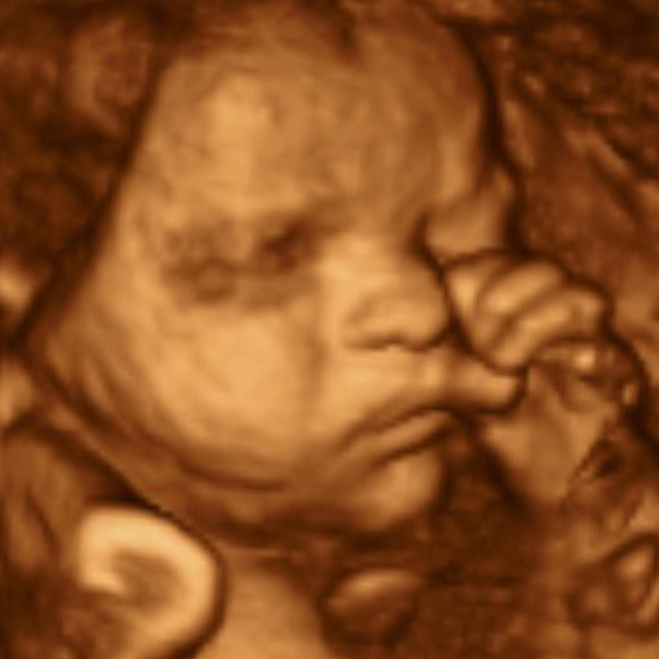 Img 1073