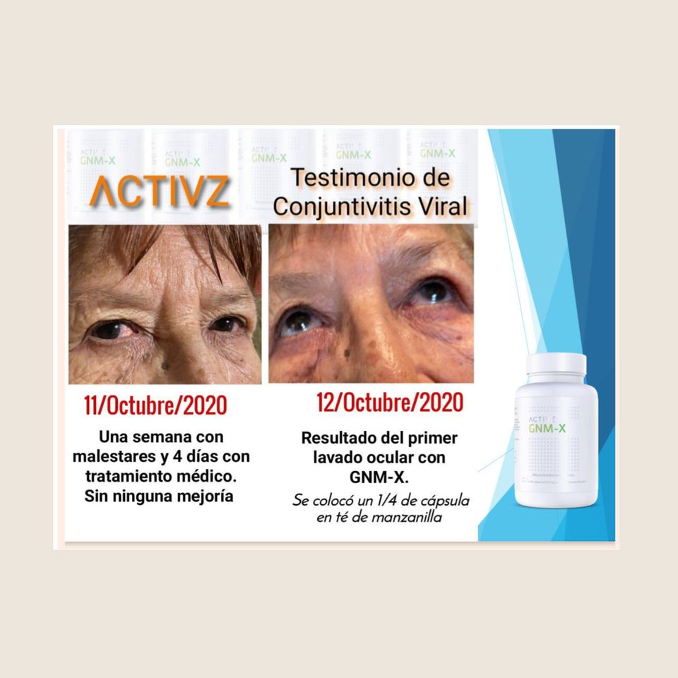 Galery activz9