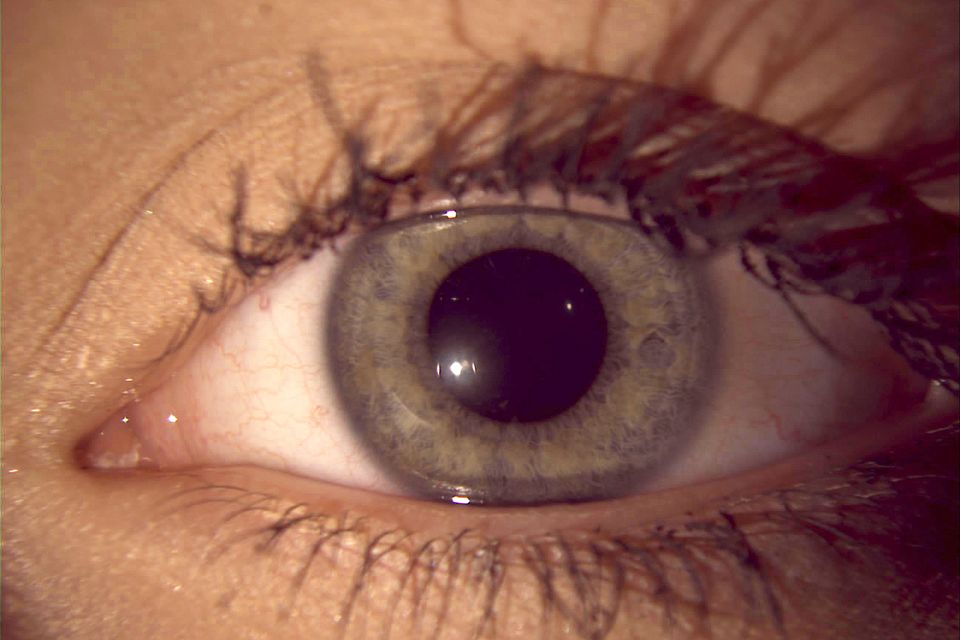 Digital Eye Exam Cullman AL Cullman Eyes