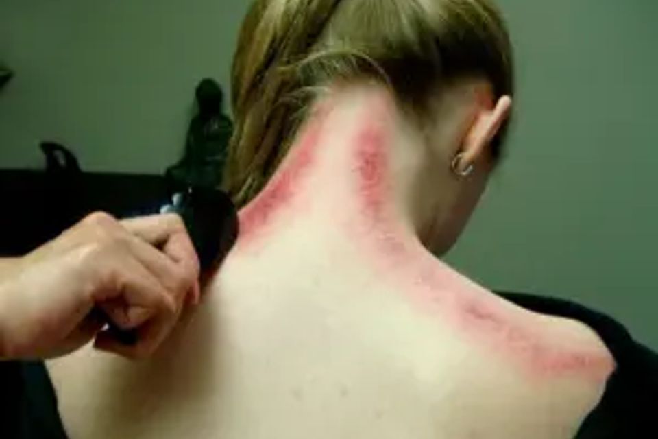 Gua sha 1