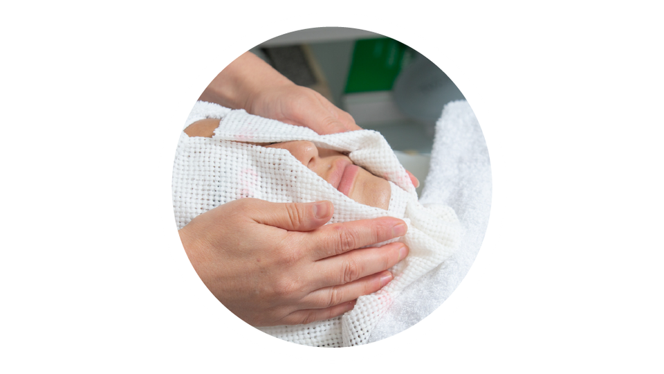 Fusion Biologics burn treatment using anti-inflammatory amniotic grafts.