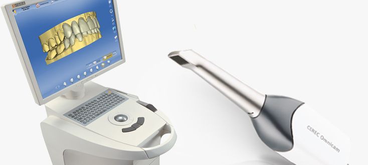 Cerec® intraoral scanning
