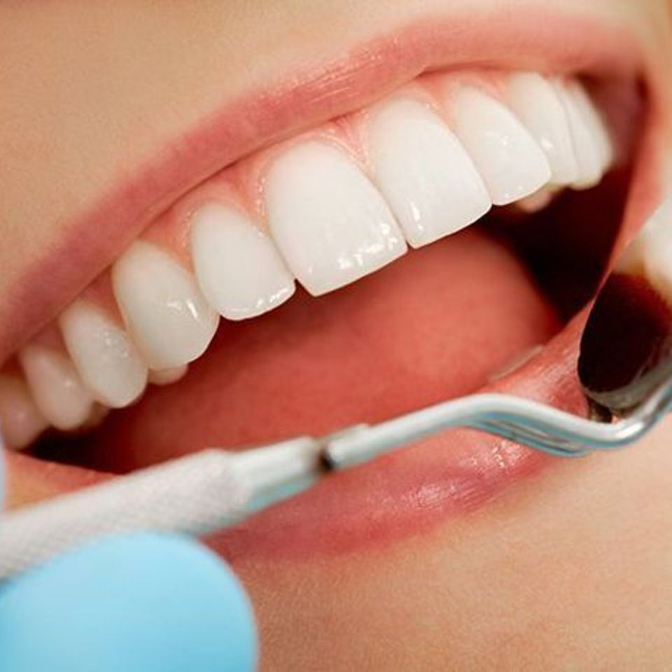Dental smile pic