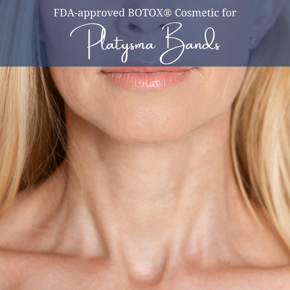 Platysma bands (5)