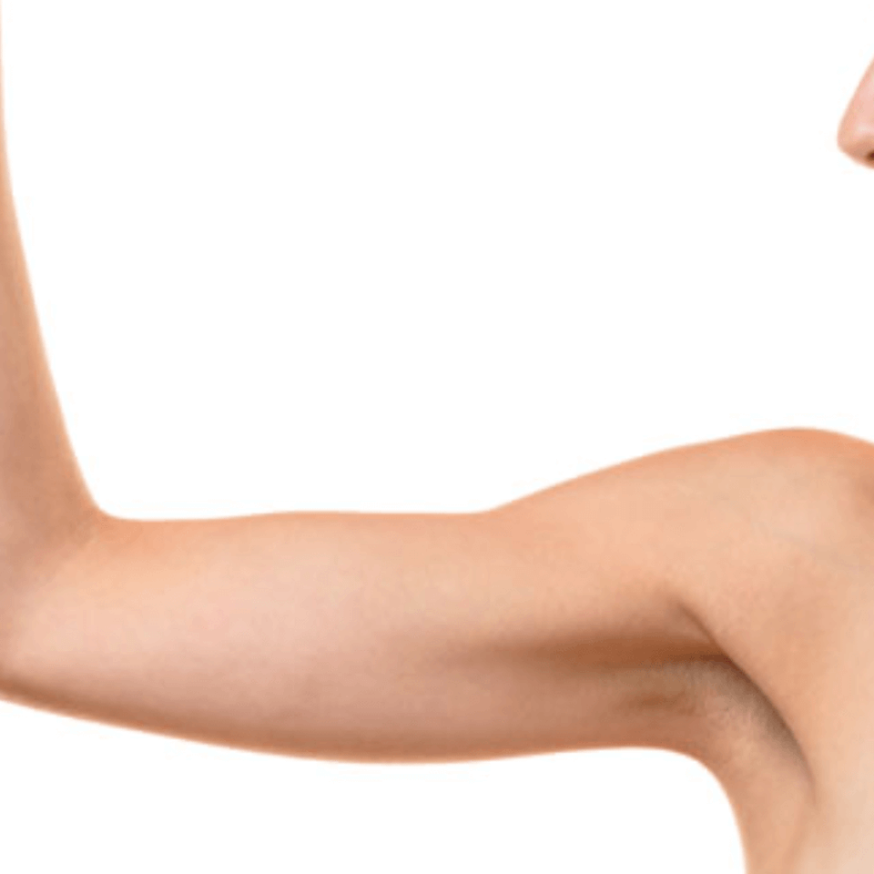 5 upper arm lift brachioplasty tn