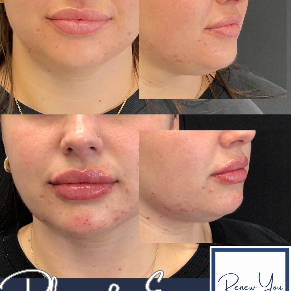 Lips   2