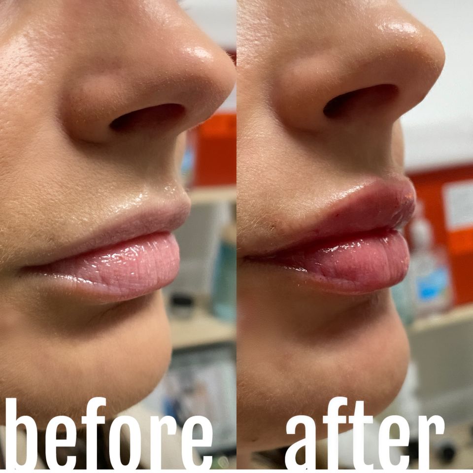 Facetune 05 07 2023 17 13 11