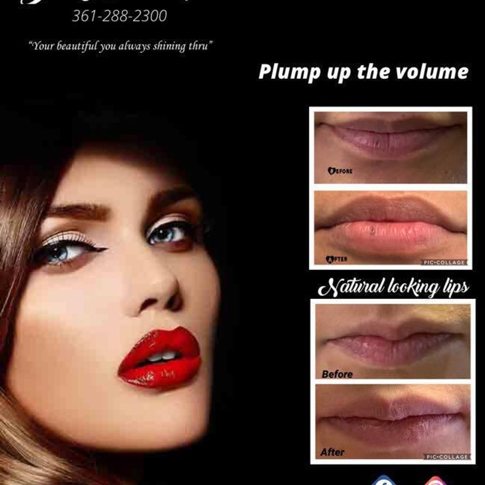 Full lips