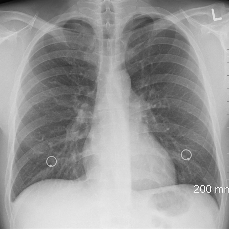 Diagnosis g87e6ac310 1920