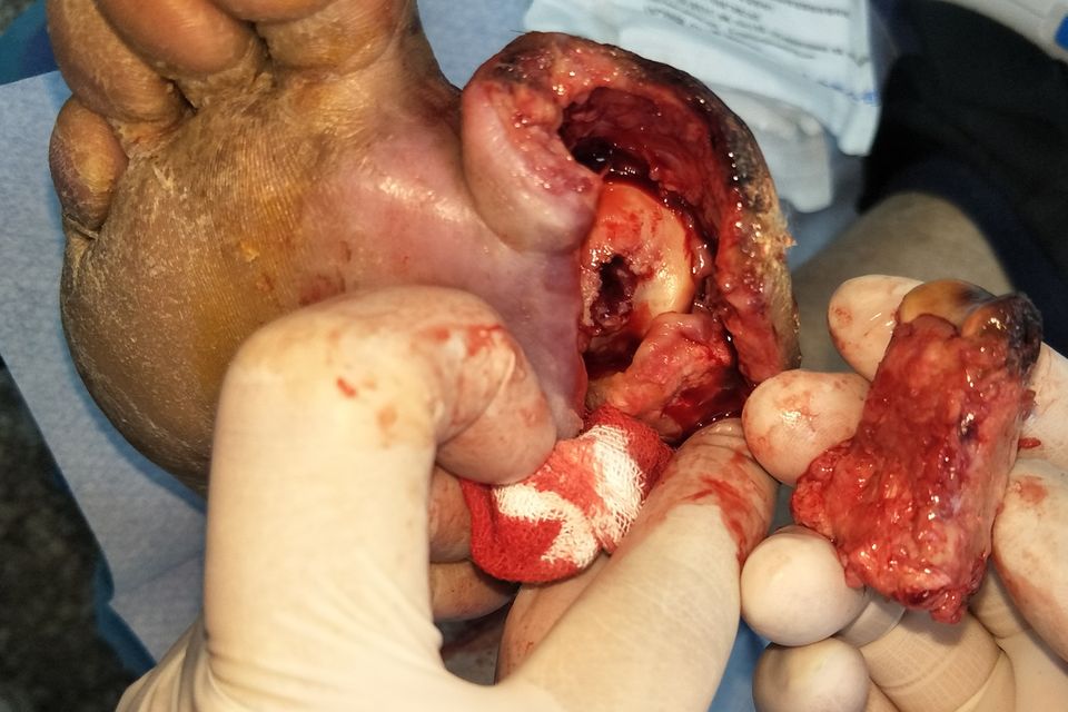Case 3 after use