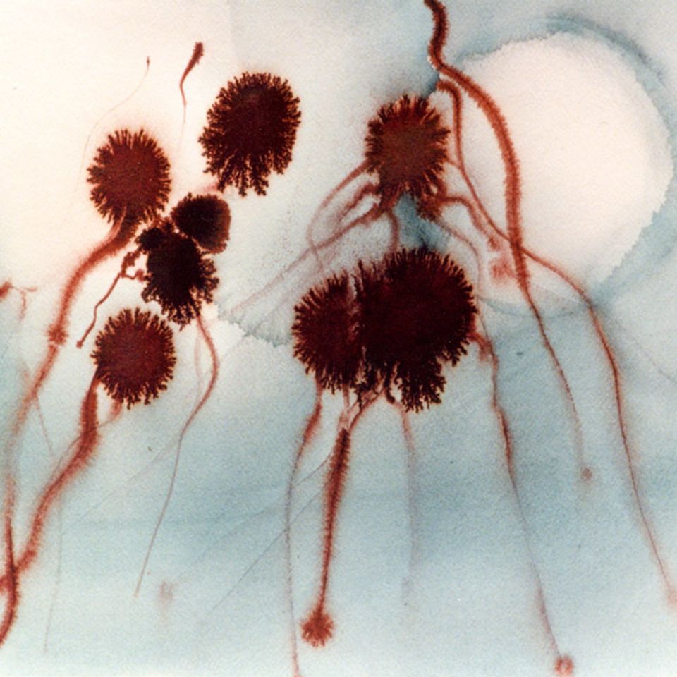 Seedpods in the wind web