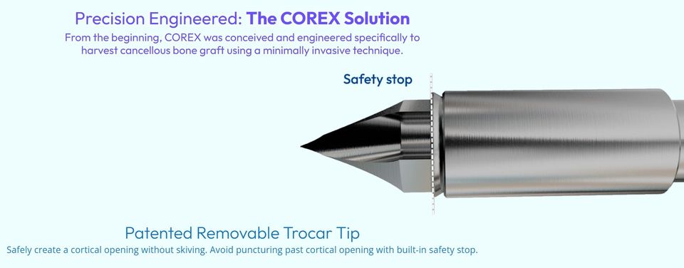 Corex 4