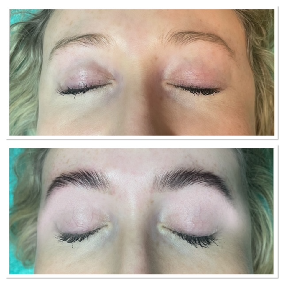 Brow lamination3