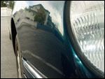 Dentsnomore.com before after 23