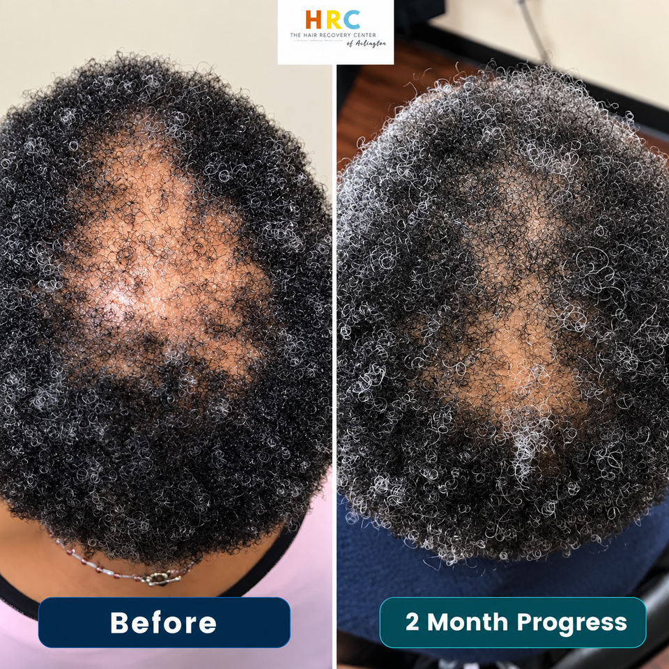 Ccca hair recovery client 7