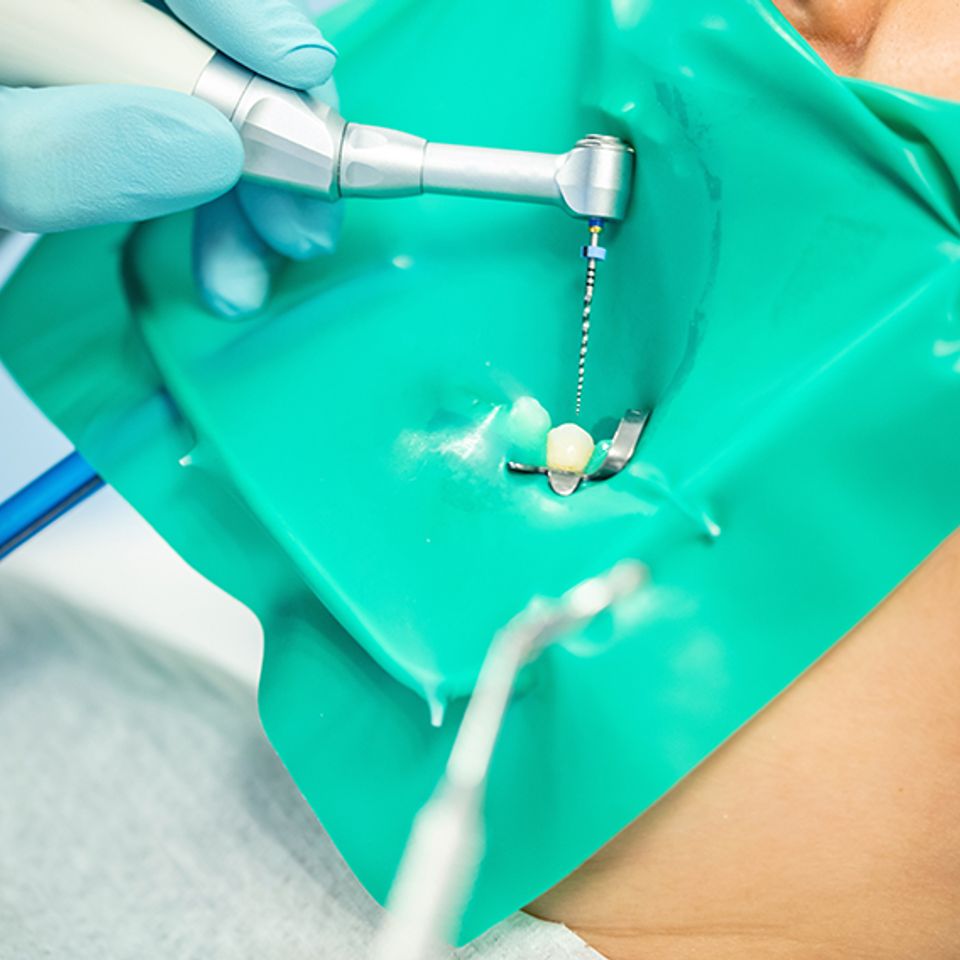 Humbert road dentistry root canal