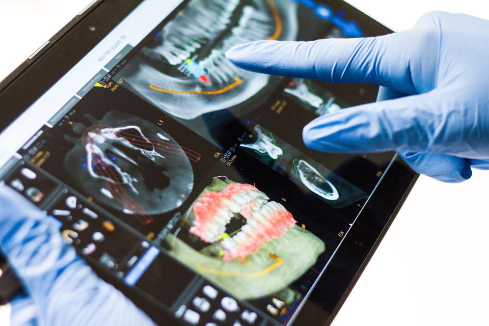 Xray pic