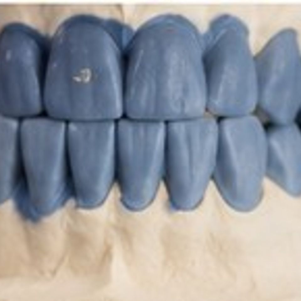 6th dental pics