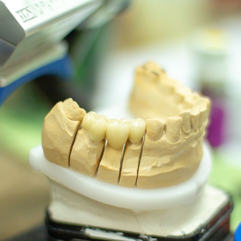 Dentures g5a13fe85f 1920