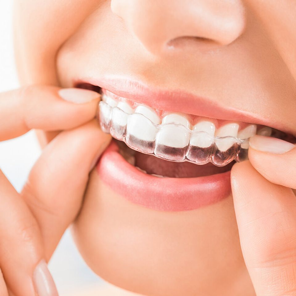 Humbertroaddentistry invisalign