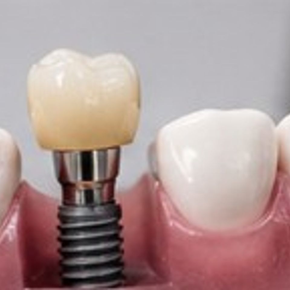 4th dental pics
