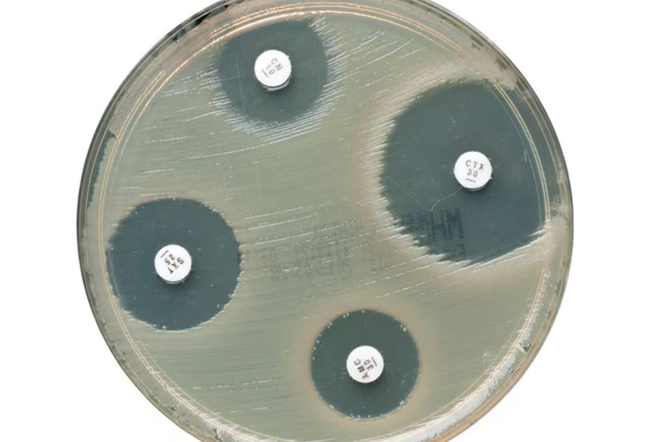 Escherichia coli atcc 35218 on mueller hinton agar plate white background.jpg 650