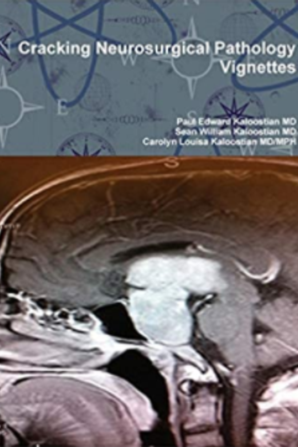 Cracking neurosurgical pathology vignettes