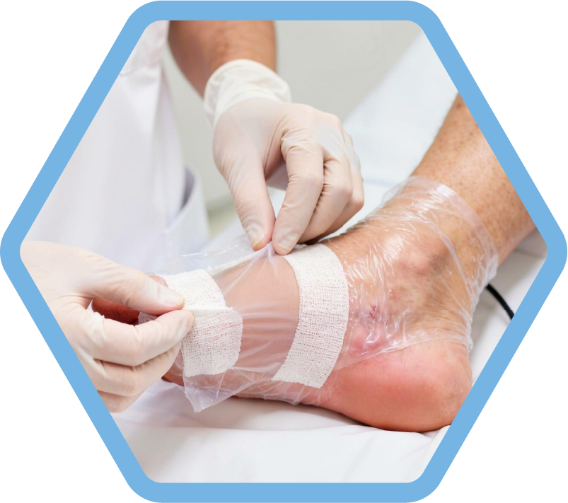 Northern wound therapies 6
