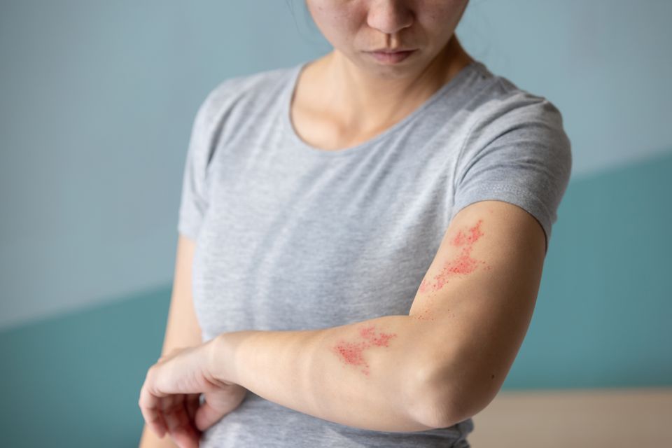 Woman.getting.medical.care.for.skin.rash