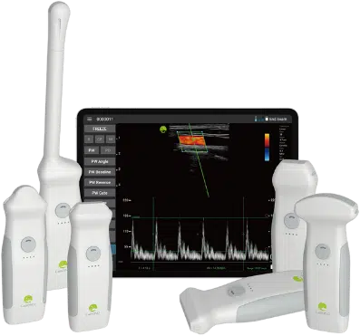 Lk128 portable ultrasound scanner 1.png