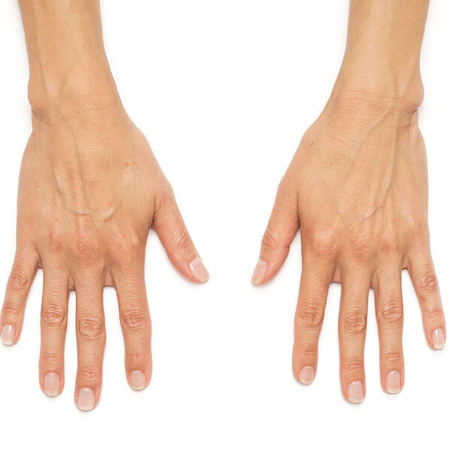 Andrea hands before