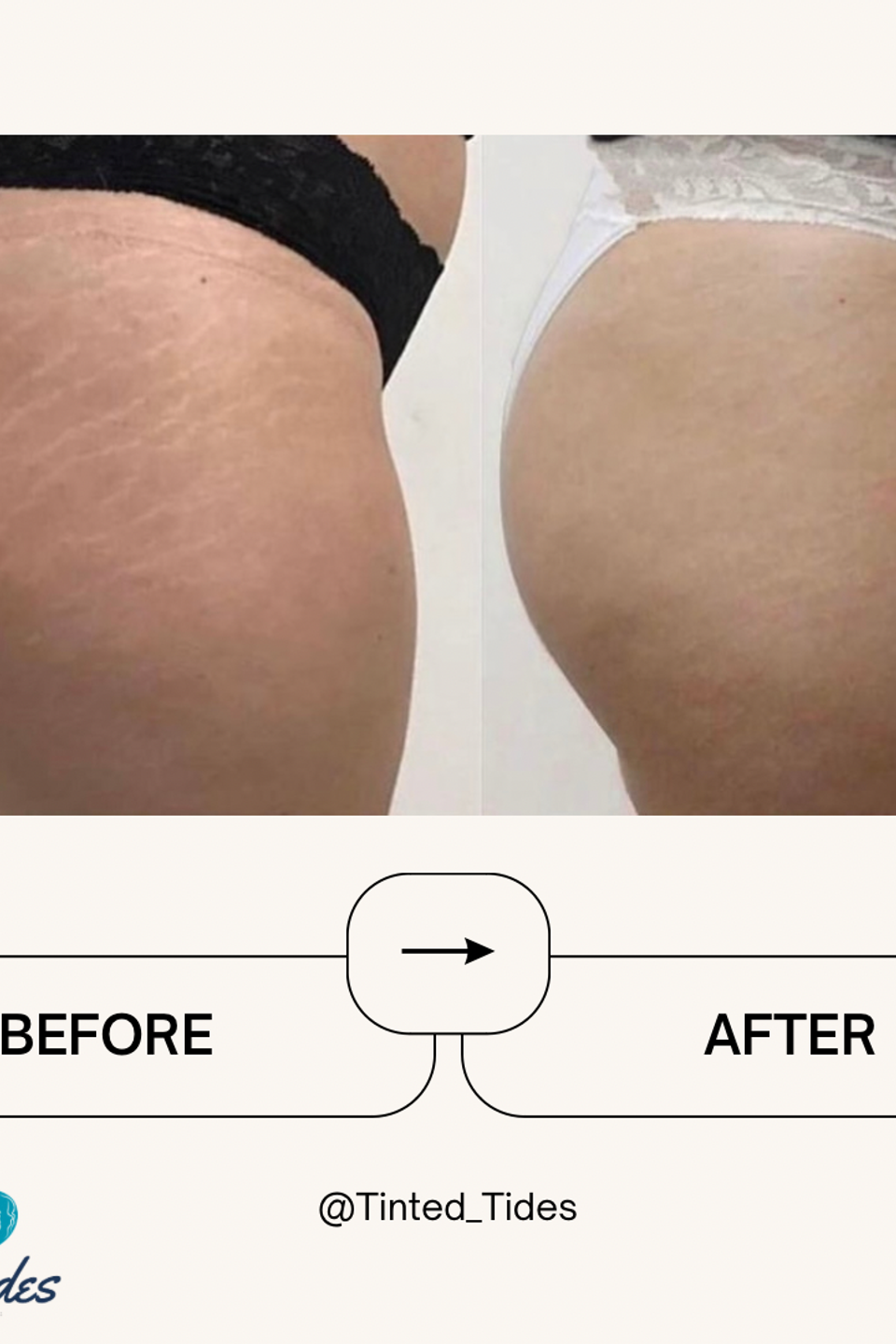 1fddb0f4 abfa 425f b279 34a0e108d758