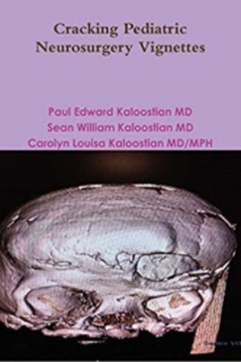 Cracking pediatric neurology vignettes   seco