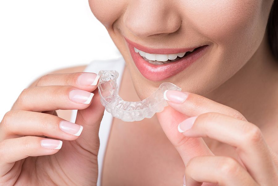 Clear Aligners, Teeth Cleaning