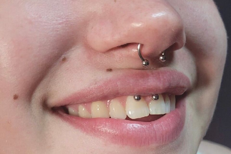 Img 2839