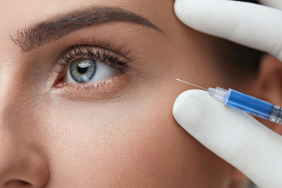 Under eye prf 2