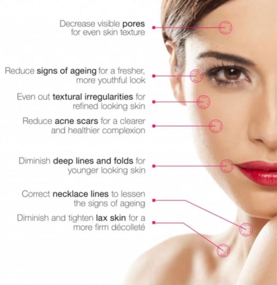 Tempimagec6r7ia original