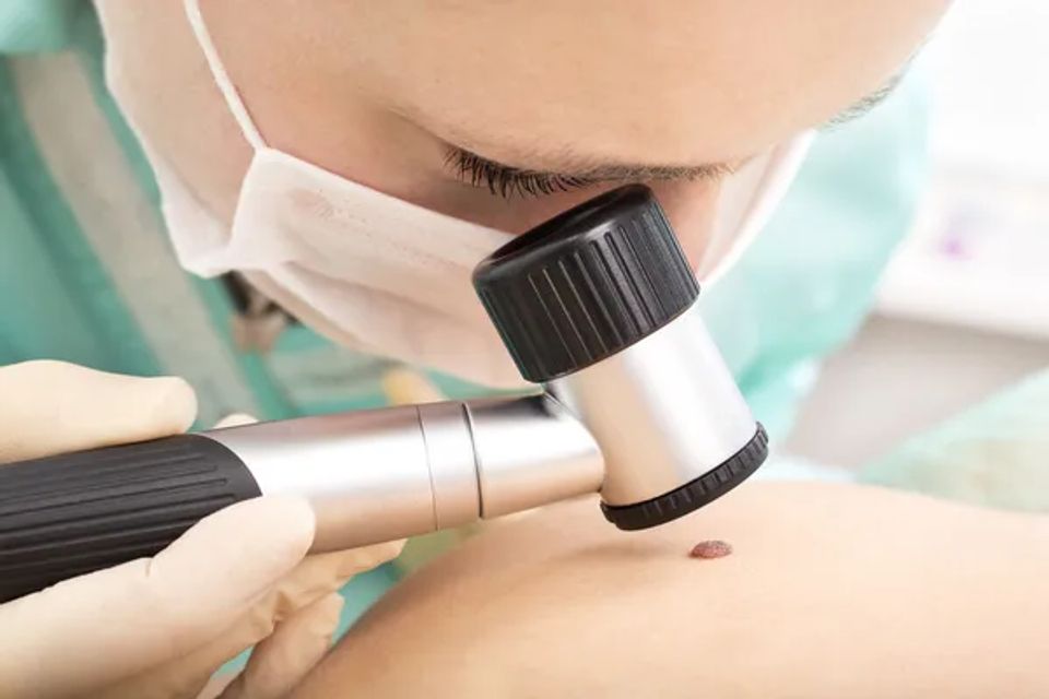Depositphotos 26089363 stock photo mole checkup