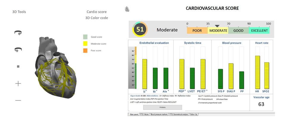 Cardiovascular score 2