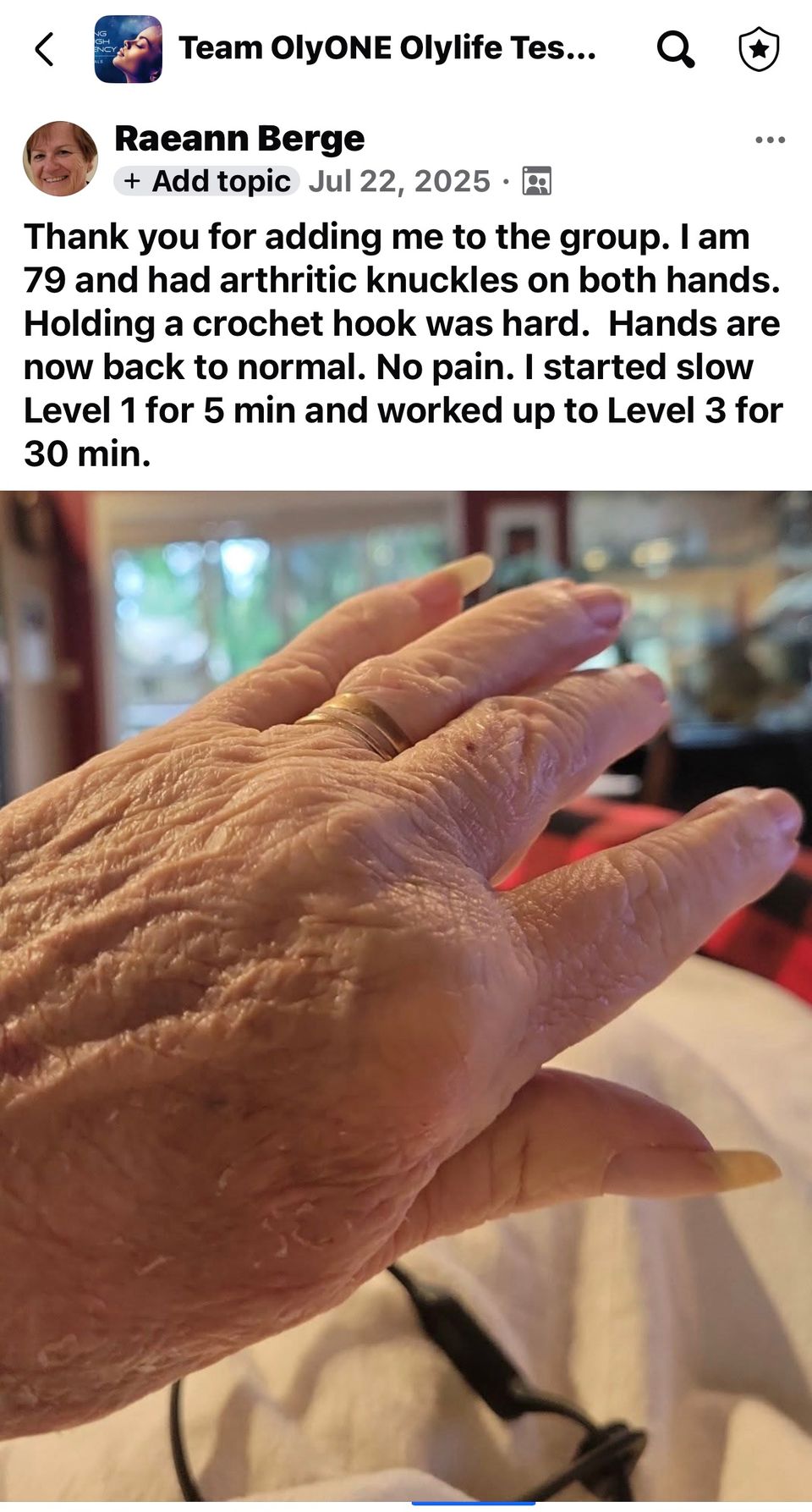 Raeann fb arthritic