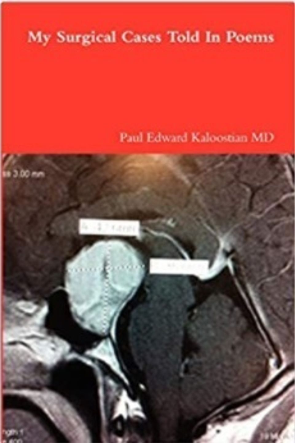 My surgical cases told in poems