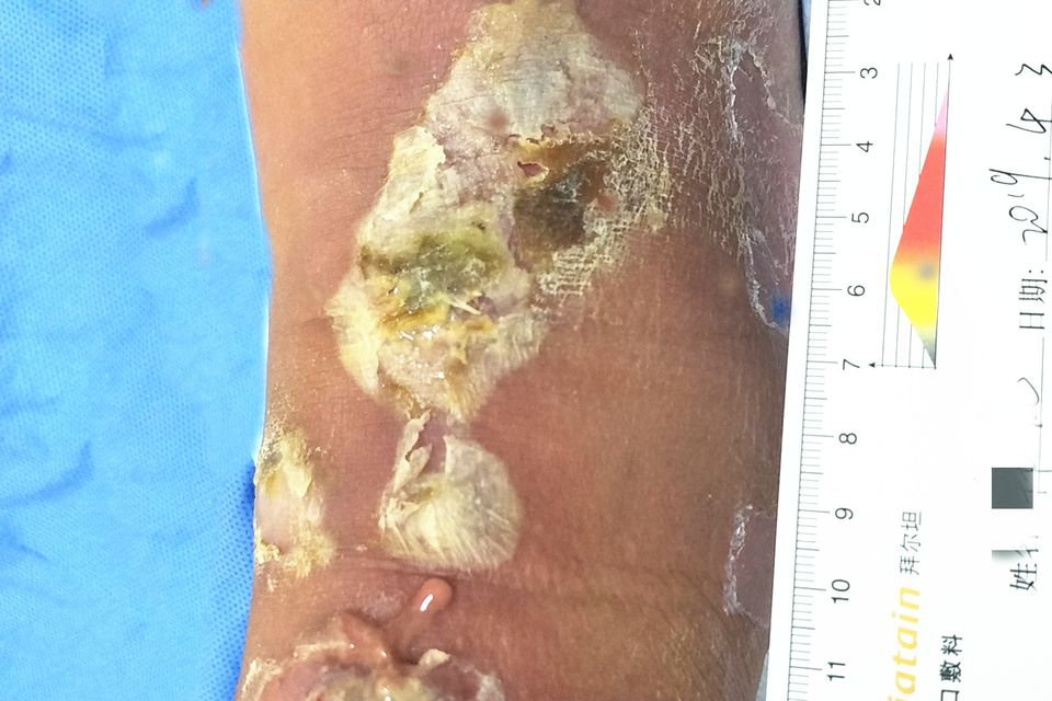 Case 4 before use