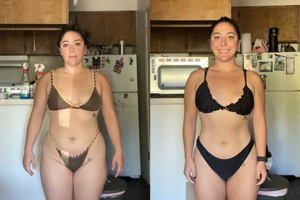 Image of a happy client before & after significant improvement. 