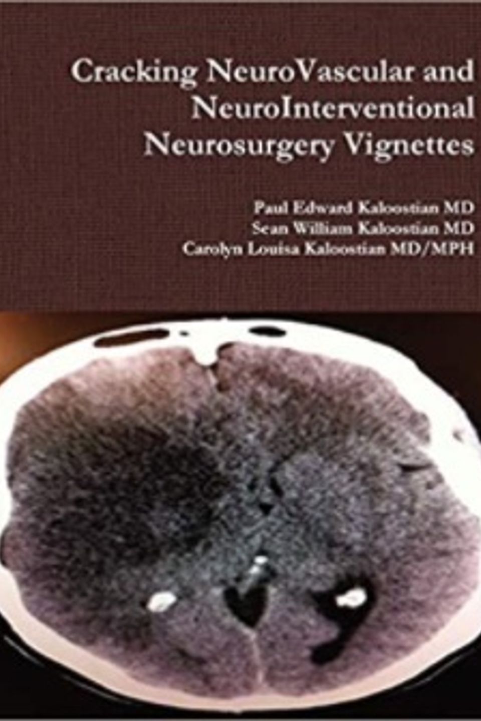 Cracking neurovascular and neurointerventional neurosurgery vignettes
