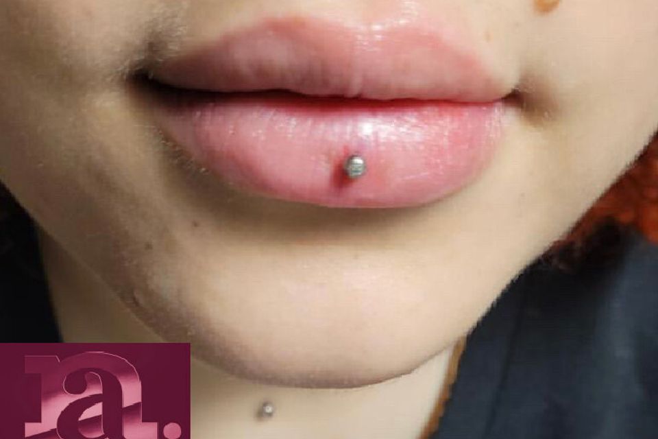 Img 2369