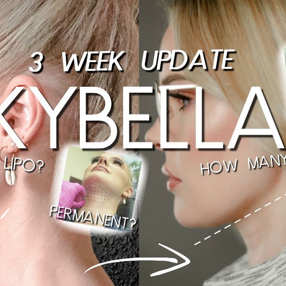 Kybella double chin removal injections at Marjan Spa serving Roseville and Fair Oaks CA