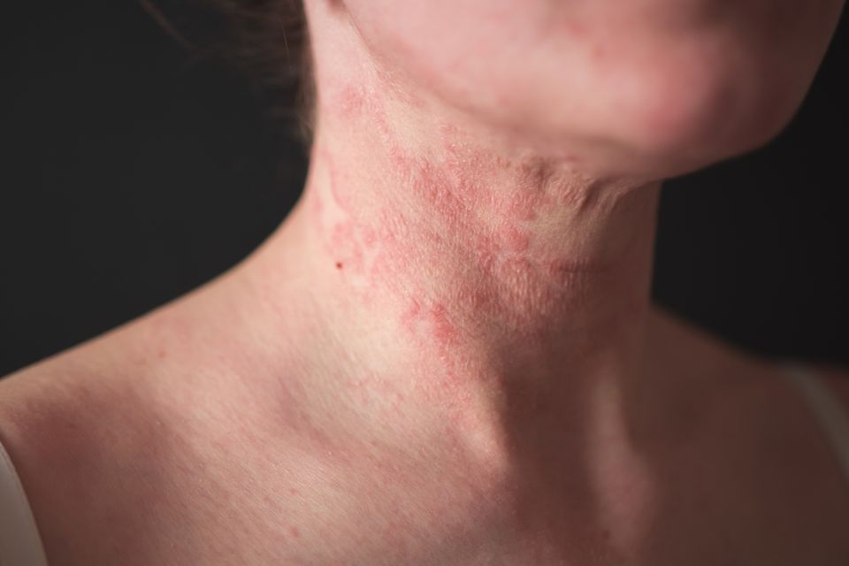Istock 1261748233