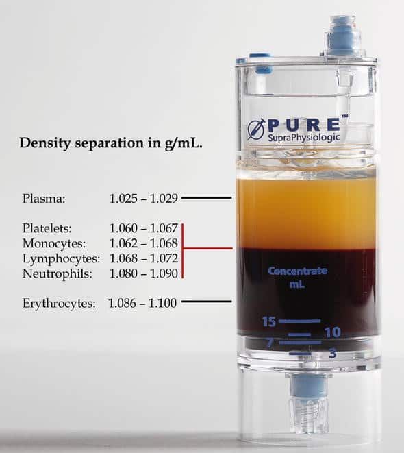Platelet rich plasma kit diagram