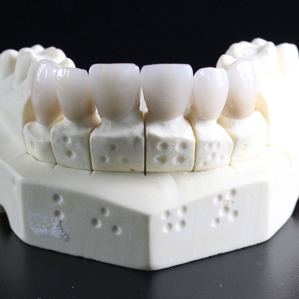 Tooth replacement 51e5dc4a48 1920