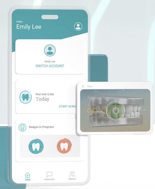 Remote dental monitoring for kids at Ellenberger Orthodontics Rocklin, reducing office visits for Phase 1 braces